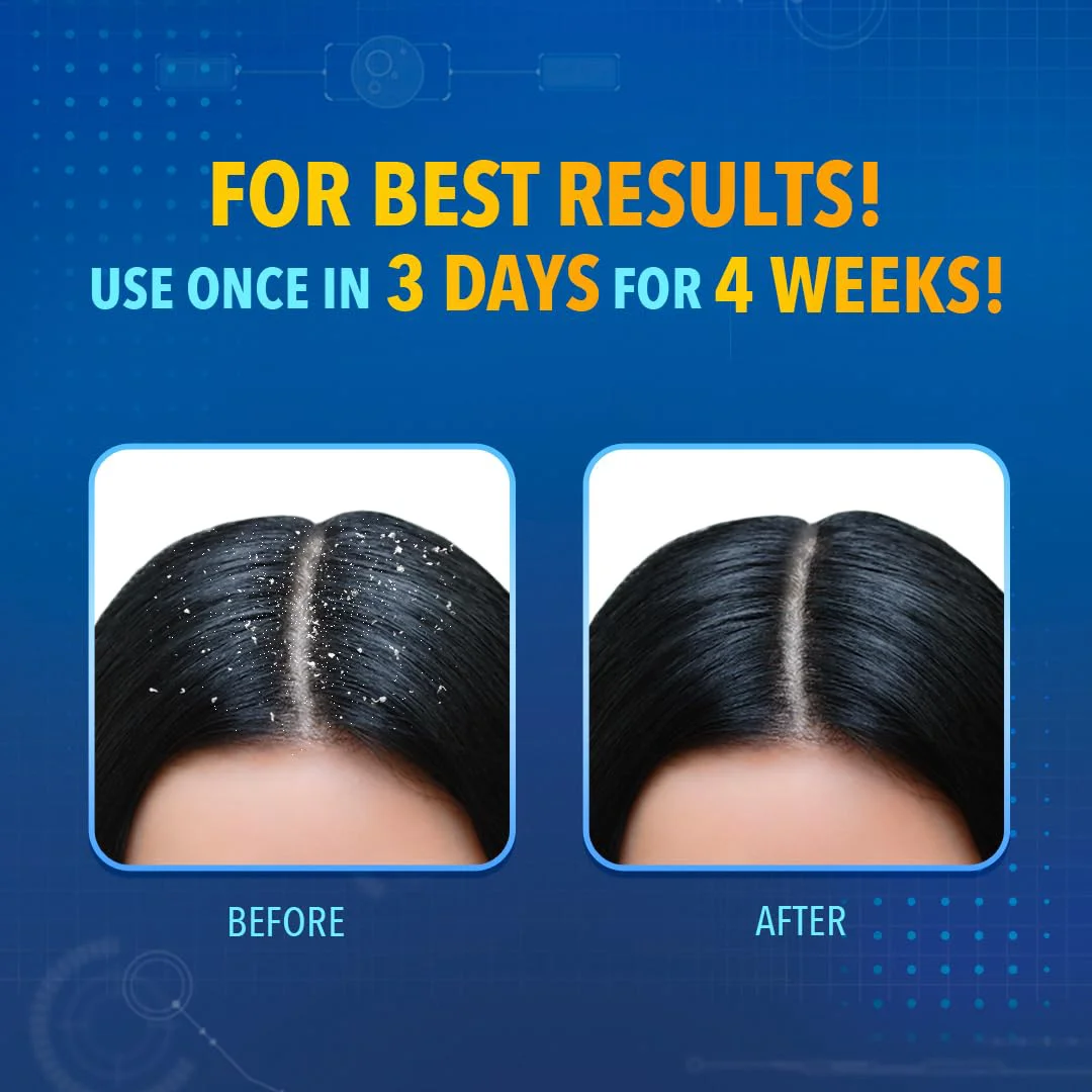 Scalpe+ Expert - Bottle of 75ml Anti Dandruff Shampoo for Men and Women with Ketoconazole and ZPTO - image 3